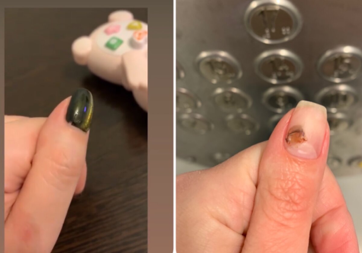 Этот тот самый маникюр с уже «дырочкой» от зуба Мурки и уже результат случайного «вскрытия». 