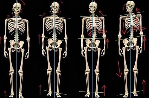 изменения во фронтальной плоскости