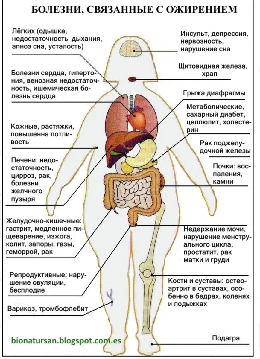 Причины развития ожирения. Осложнения при ожирении. Влияние лишнего веса на организм. Какие заболевания при ожирении. Болезни избыточного веса.