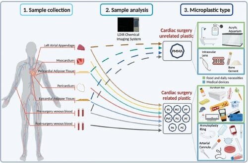    Пластик в сердечно-сосудистой системе / ©ACS Environmental Science & Technology