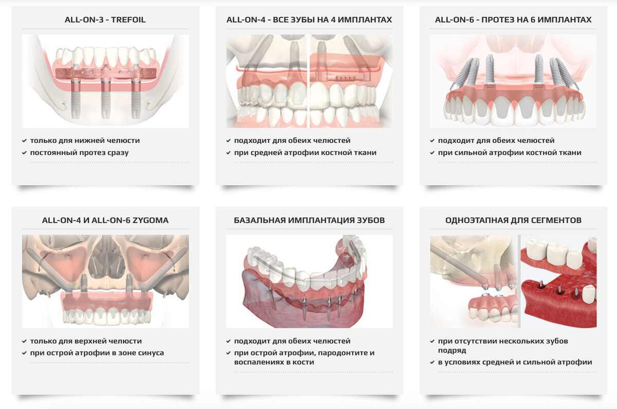 Имплантация отзывы. Дентальная имплантация хирургический протокол. Имплантация зубов протоколы. Имплантация нескольких зубов. Брошюра по протезированию на имплантатах.