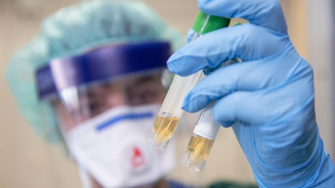фото с сайта:https://kaz.tengrinews.kz/kazakhstan_news/tagyi-ek-oblyista-koronavirus-anyiktaldyi-306549/