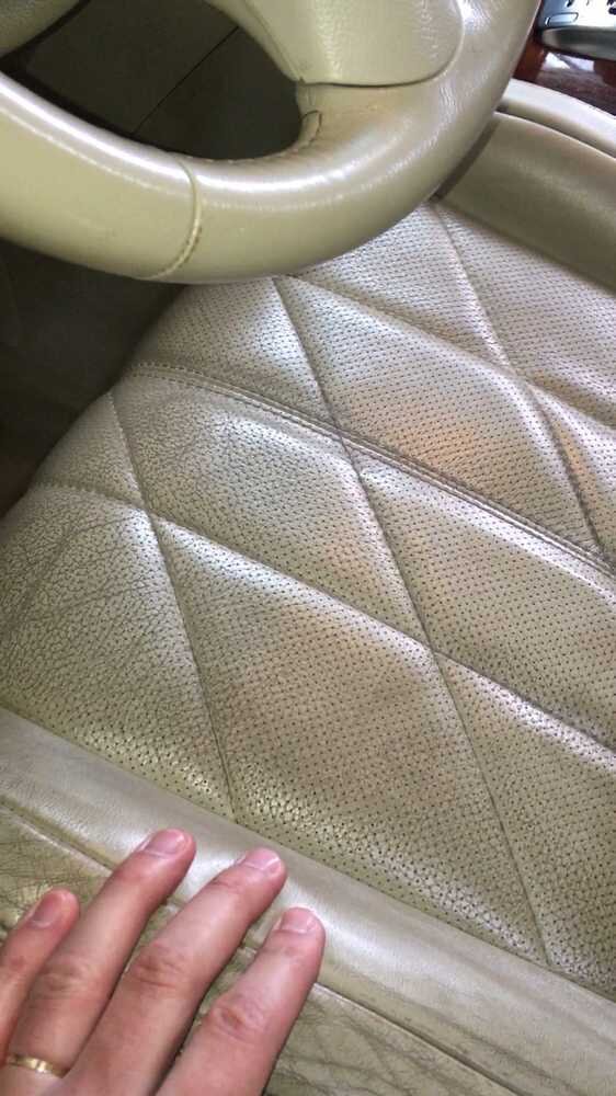 Кожа потемнела от обычной грязи и покрасилась от одежды.