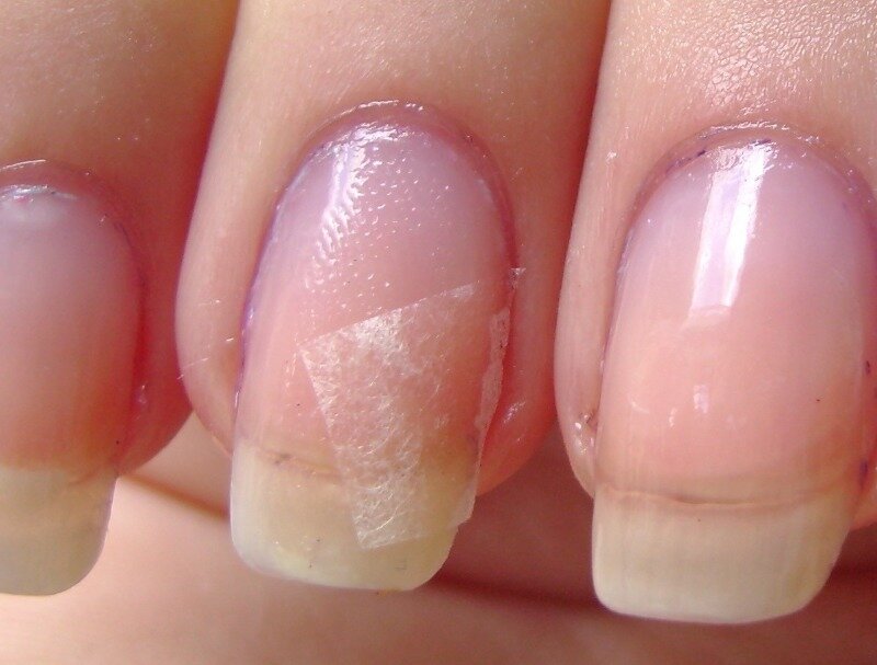 Источник фото nailshapes.net