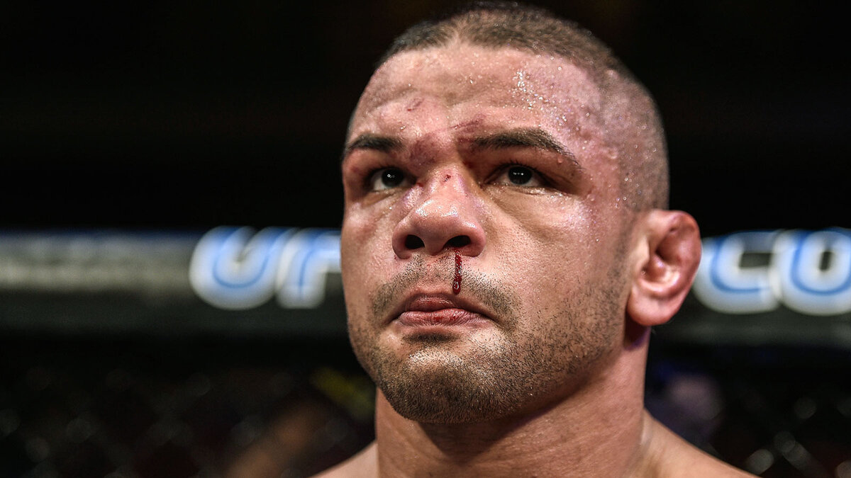 Кровоподтеки появились на лице Алвеса еще в первом раунде