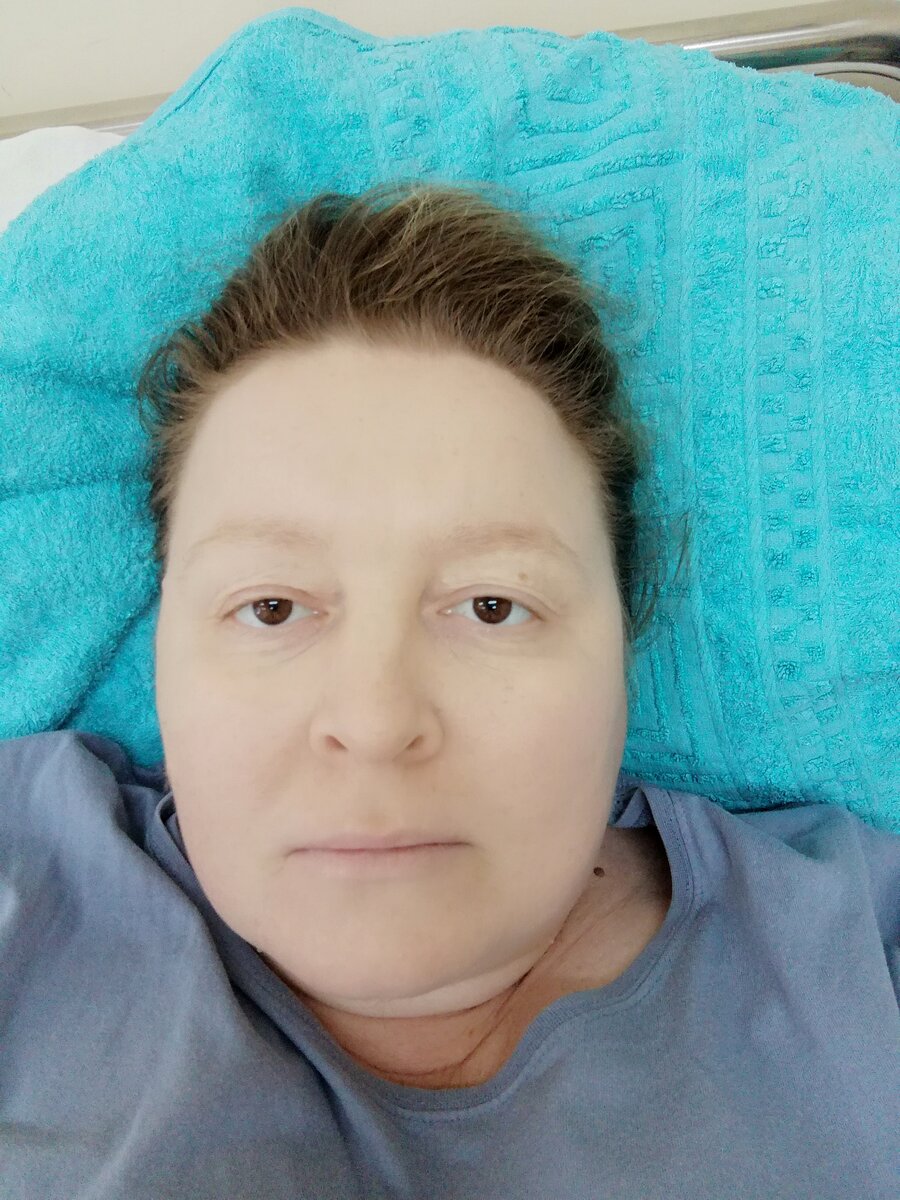 Гемоглобин 55