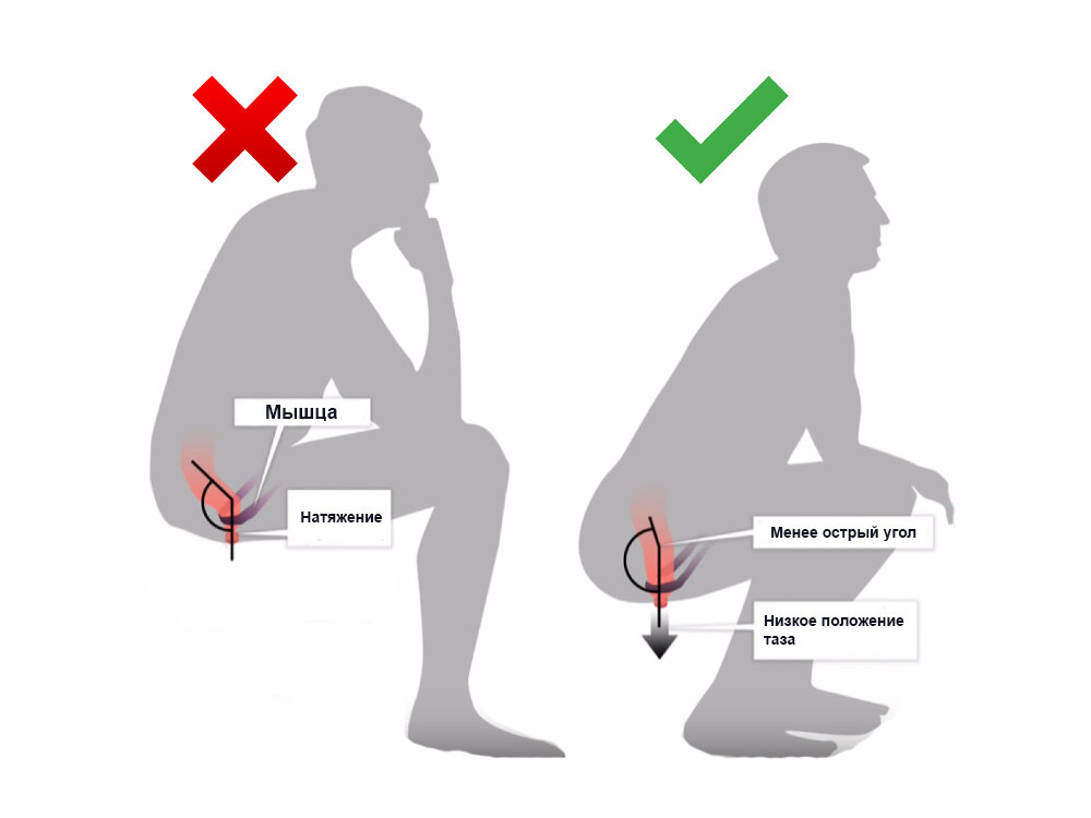Как правильно сидеть на унитазе при опорожнении кишечника фото