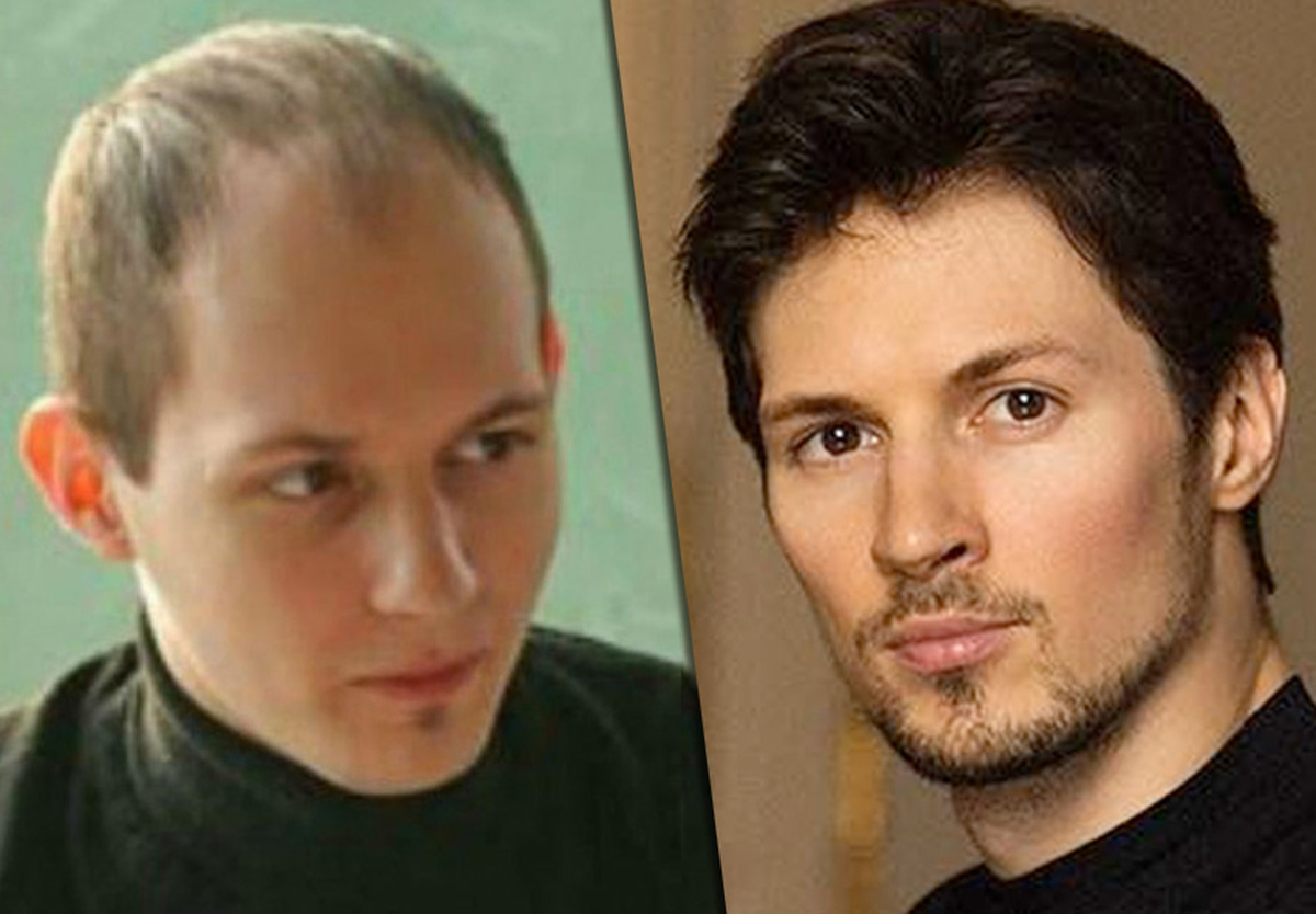 Пользователи Сети уверены, что Павел Дуров сделал наращивание или пересадку волос