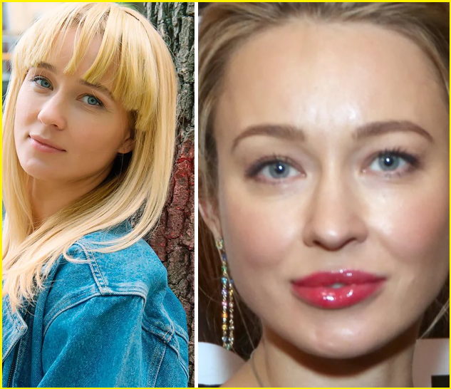 Губы "до" и "после" 