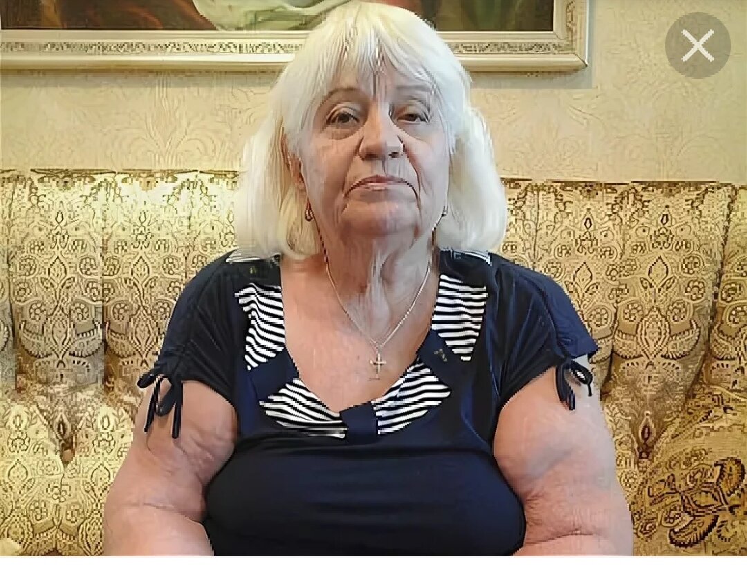 Знаменитая женщина рентген из Донецка.