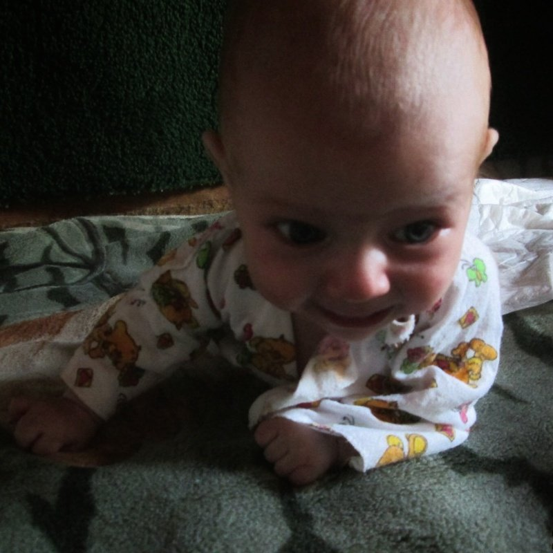 После кесарева сечения все дети получают микротравму шейного отдела позвоночника