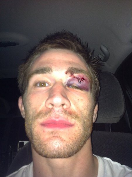 Фото с сайта https://stebok.net/zhest/4678-foto-lyudey-poluchivshih-lyuley-na-ulichnyh-drakah.html