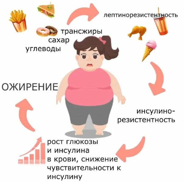 Инсулинорезистентность в картинках