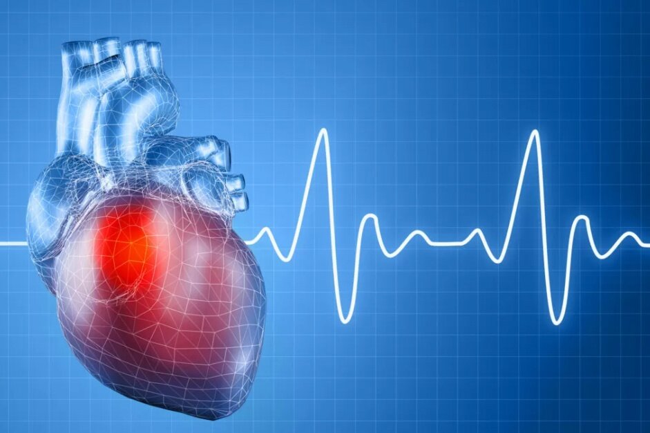 Что такое аритмия. Причины ее появления.
