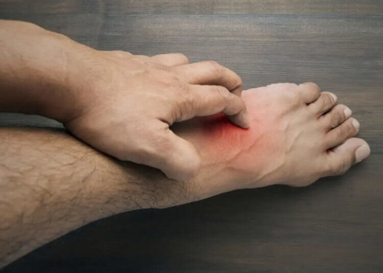 Зуд может быть симптомом опасных заболеваний 