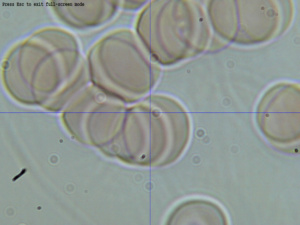 Рис. 1. Структура крови человека в 60-летнем возрасте