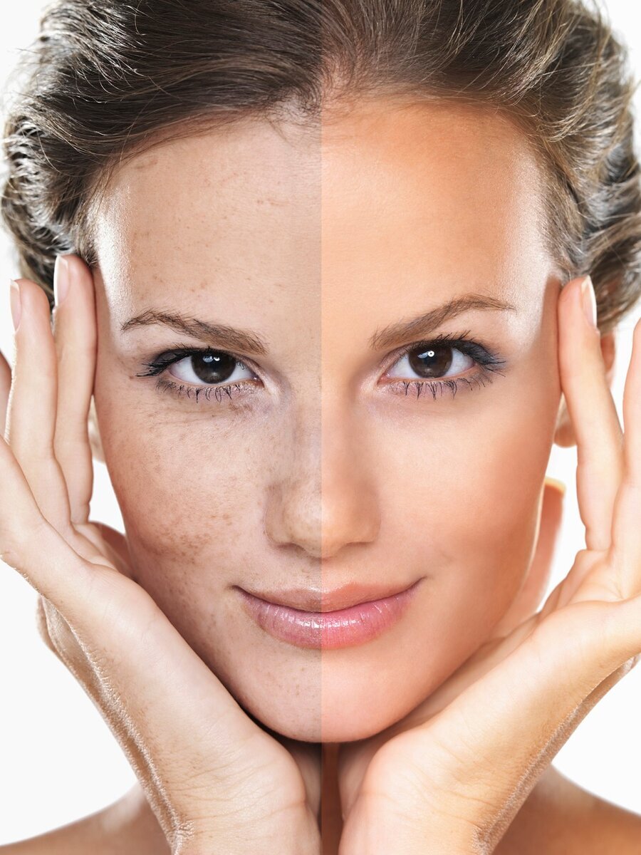 Красивая кожа, залог уверенности в себе! 