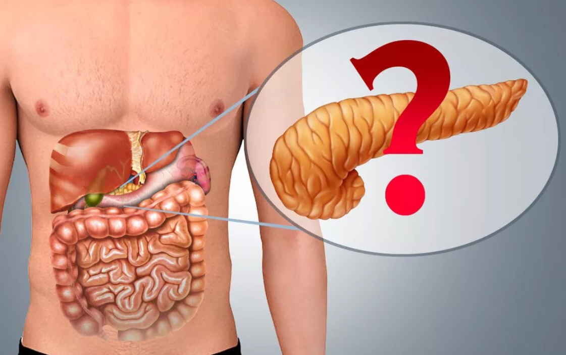 Давит поджелудочная. Панкреатит поджелудочной железы. Панкреатин поджелудочная железа. Болит поджелудочная железа. Поджелудочная железа фото.