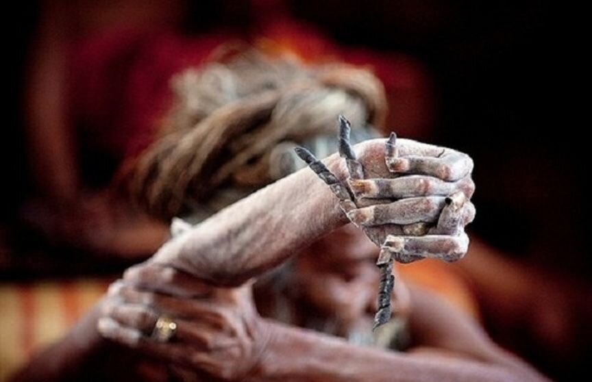  Тут видно насколько пугающе выглядят ногти и безжизненно рука