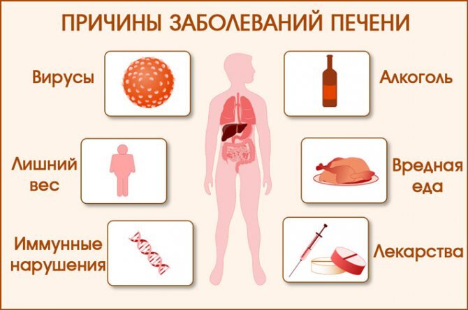 Признаки синдрома портальной гипертензии и методы его лечения — клиника «Добробут»