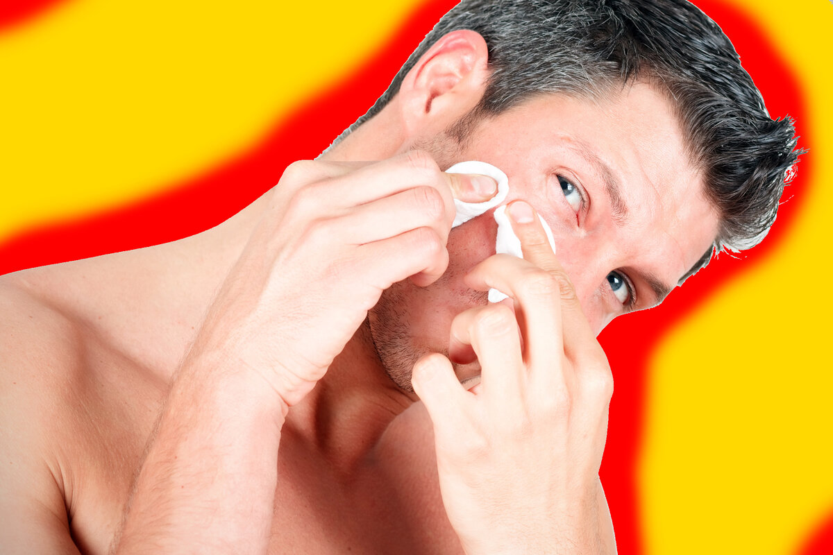 Как быстро избавиться от прыщей (акне)?