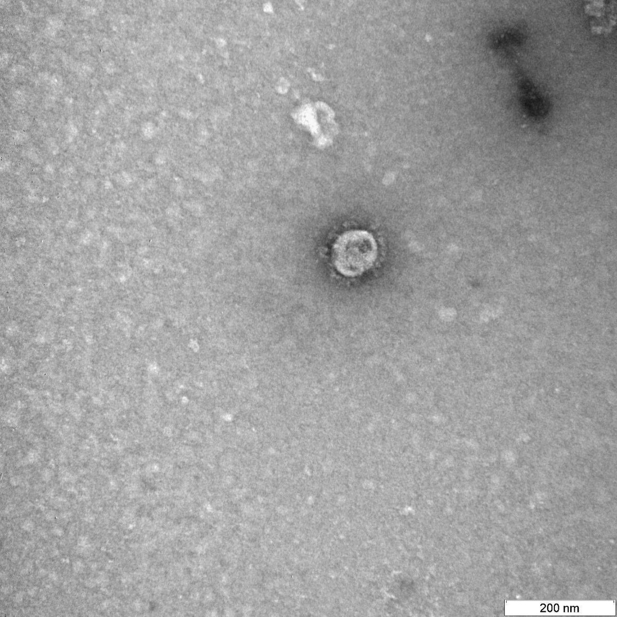 Снимки: Роспотребнадзор