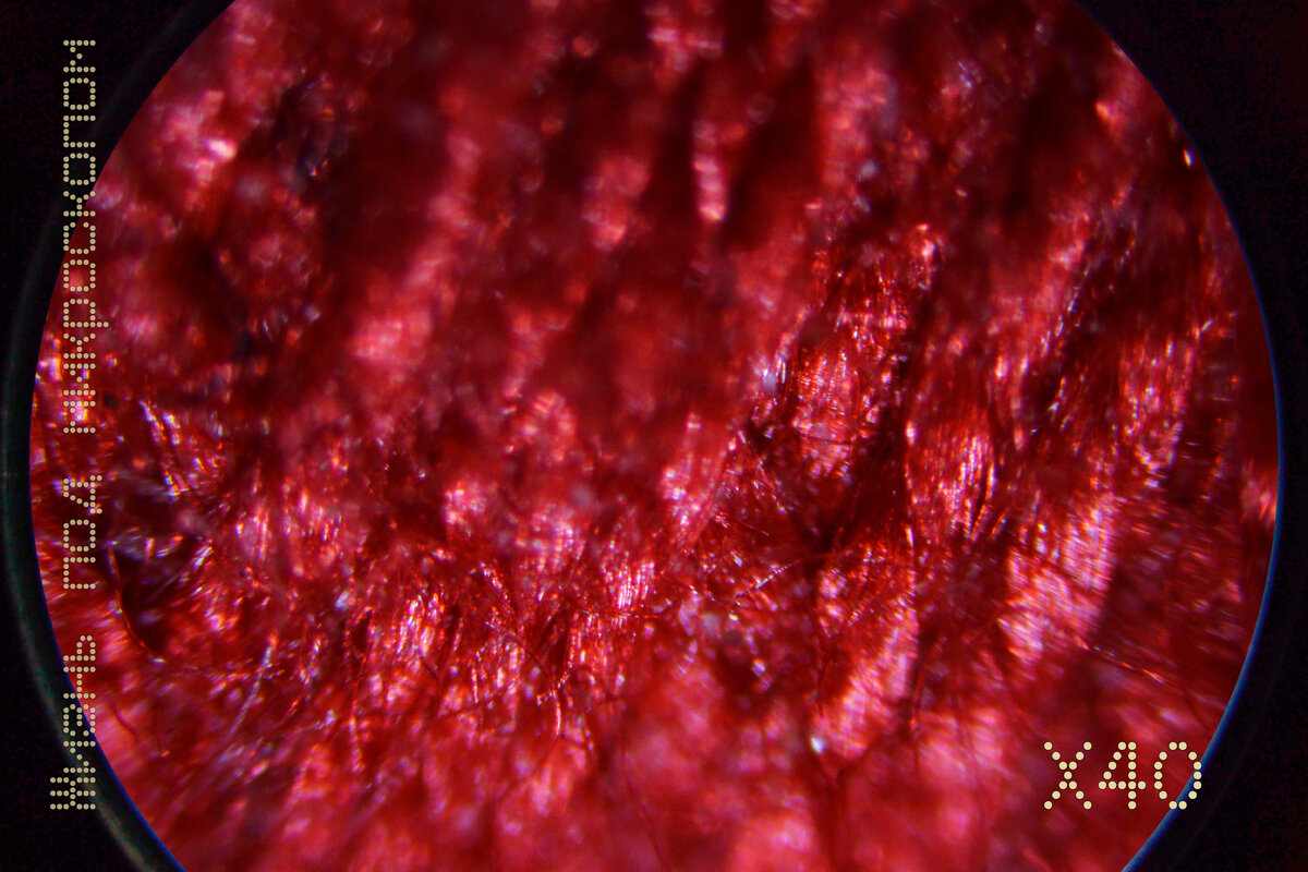 Так выглядят намотанные нитки увеличенные в 40 раз.