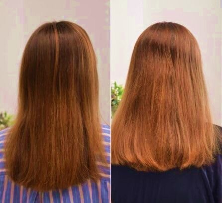 Рост и восстановление волос