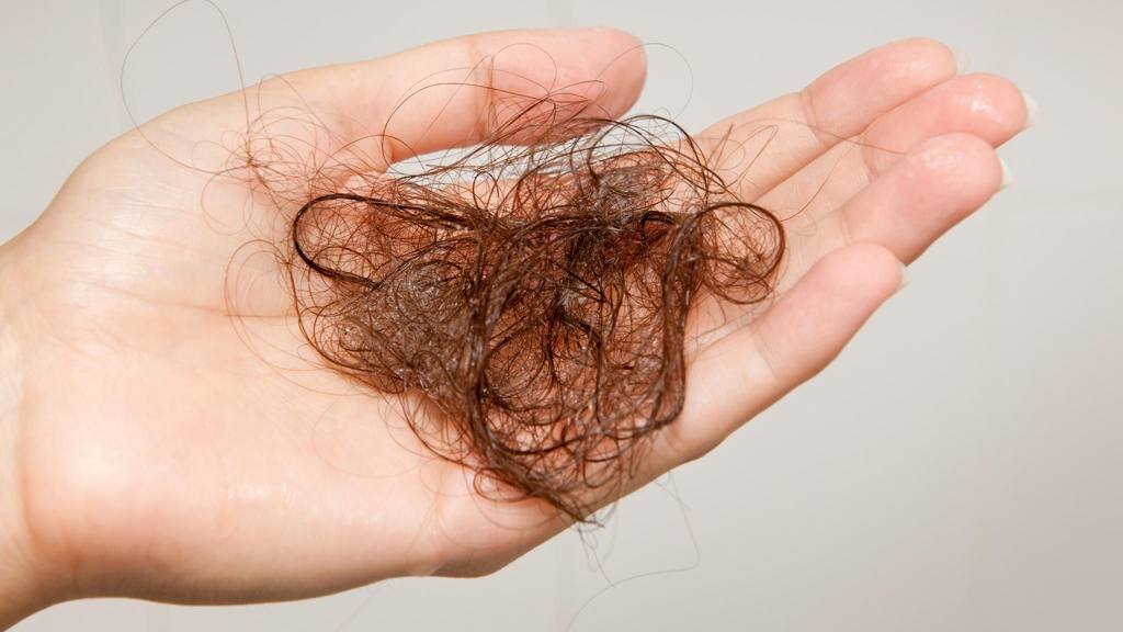 Почему после мытья выпадают волосы?