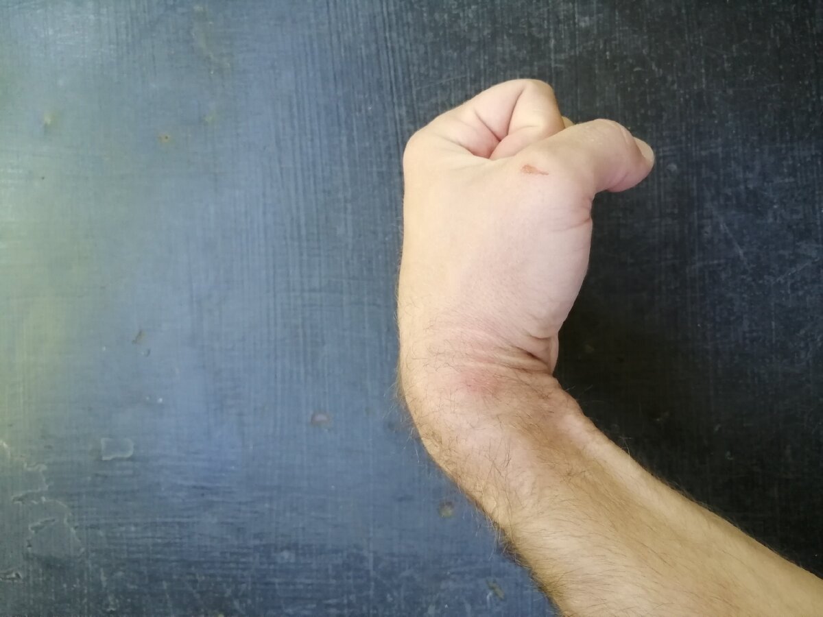 Боль при сгибе