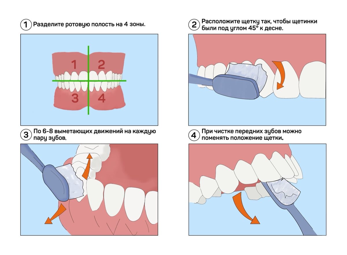 Стандартный метод чистки зубов схема
