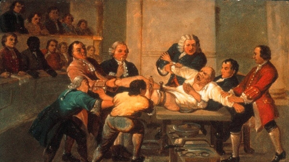 История анестезии