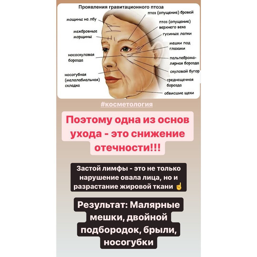 Листайте галерею ->