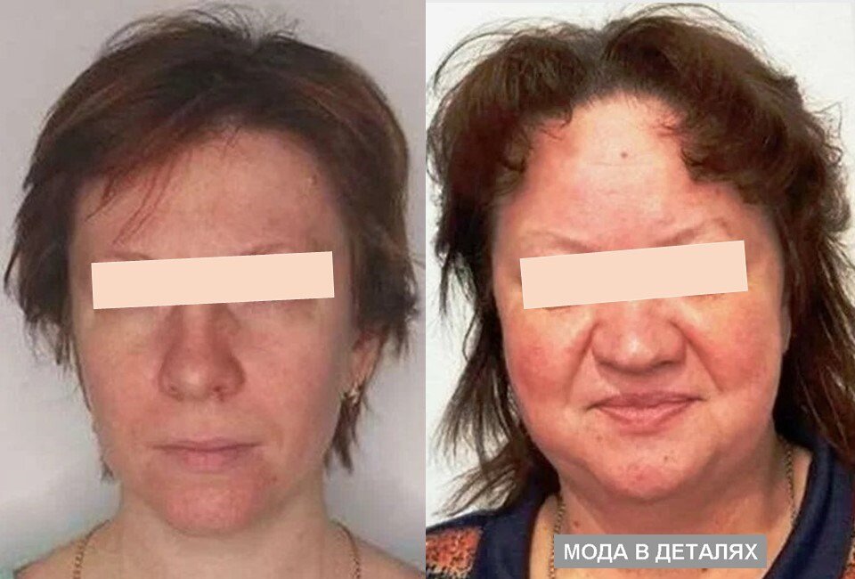 ФОТО ИЗ СВОБОДНОГО ДОСТУПА