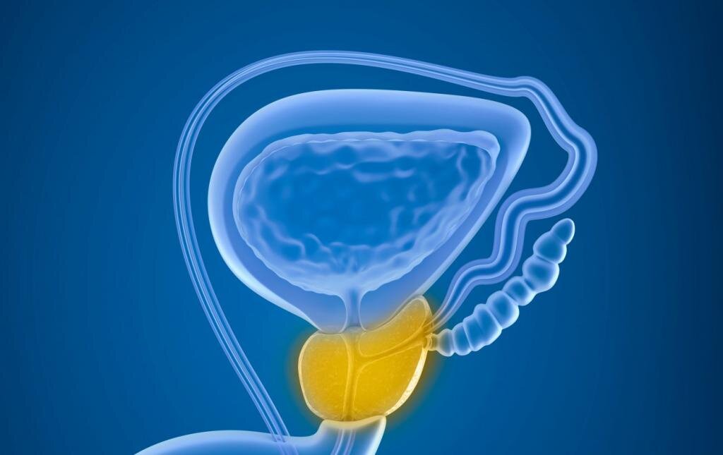 Простатит в картинках