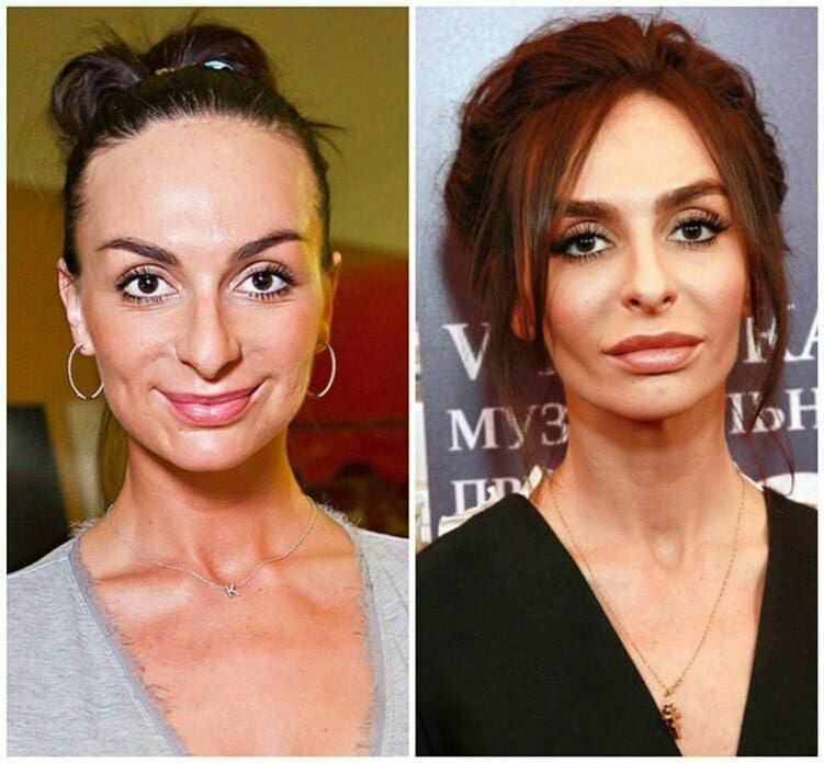 Екатерина варнава до и после фото