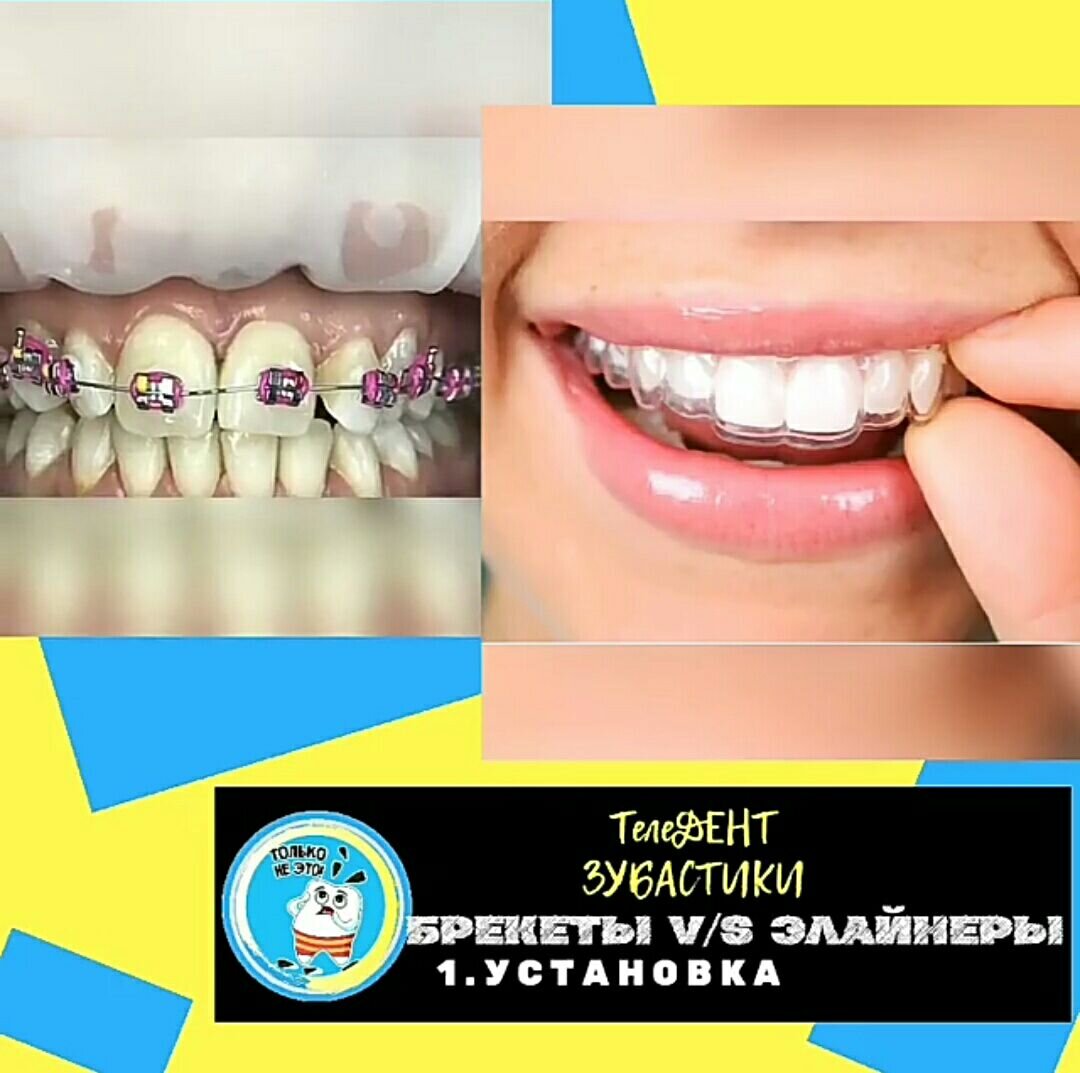 👇 смотрите видео ниже 👇