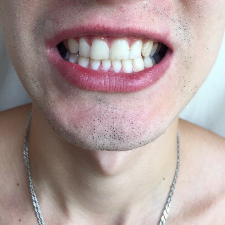 Подпишись на канал и моя улыбка будет еще шире!