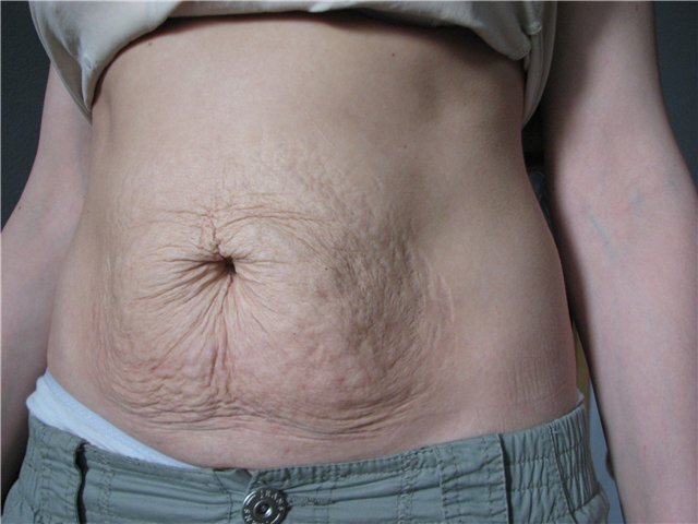 Фото взято с сайта https://www.kleos.ru/forum/uploads/monthly_11_2014/post-16276-0-63353300-1417376073.jpg