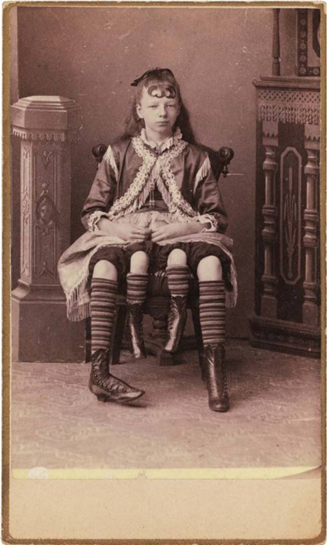 Четвероногая женщина