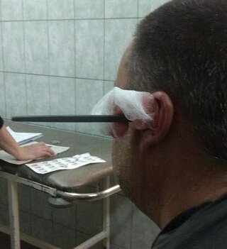  В Саратове. 43-летний мужчина по имени  Василий страдал из-за того, что слышал голоса.  Решив избавиться от своей проблемы он взял напильник и воткнул его себе в голову.
