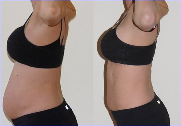 «Растянутый желудок»: Эффективный массаж и упражнение для похудения и снижения аппетита