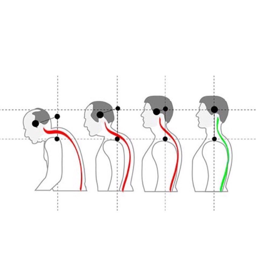 Осанка положение головы. Осанка. Правильное положение осанки. Осанка положение головы. Положение головы осанка.