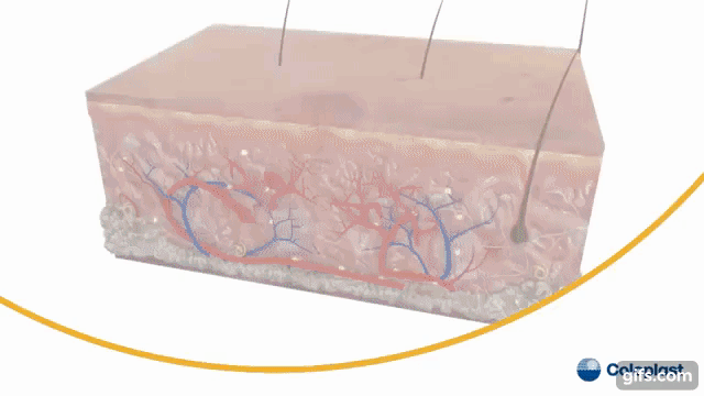 Укрепление.