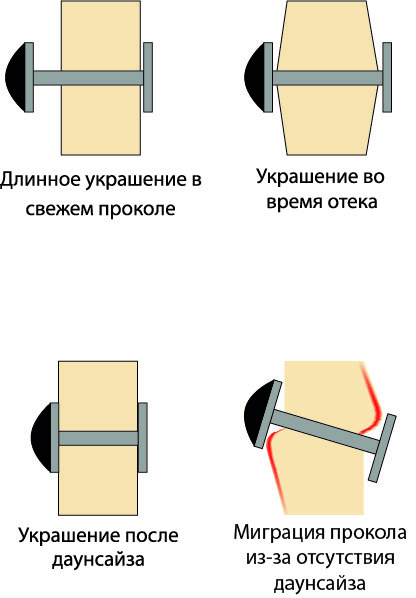 Даунсайз схематично