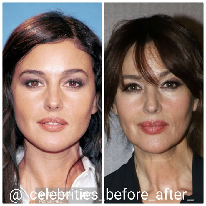 Фото: @_celebrities_before_after_ 