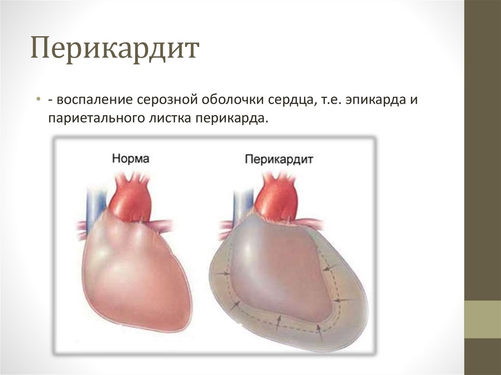 Оболочки сердца Оболочки сердца