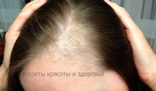 Источник: Яндекс Картинки