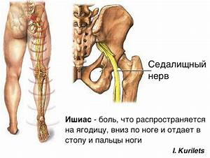 Онемение ног при грыже позвоночника | «Здравствуй»