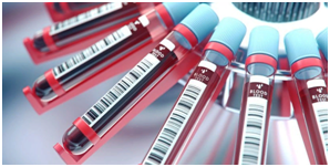 Centrifugation of blood in the laboratory.